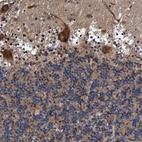 Immunohistochemical staining of human cerebellum shows strong cytoplasmic positivity in Purkinje cells.