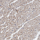 Immunohistochemical staining of human heart muscle shows moderate cytoplasmic positivity in cardiomyocytes.