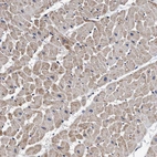 Immunohistochemical staining of human heart muscle shows moderate cytoplasmic positivity in cardiomyocytes.