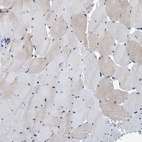 Immunohistochemical staining of human skeletal muscle shows very weak cytoplasmic positivity in myocytes.