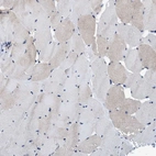 Immunohistochemical staining of human skeletal muscle shows very weak cytoplasmic positivity in myocytes.