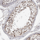Immunohistochemical staining of human testis shows strong nuclear positivity in spermatogonia.
