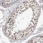 Immunohistochemical staining of human testis shows strong nuclear positivity in spermatogonia.