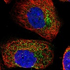Immunofluorescent staining of human cell line A-431 shows localization to vesicles.