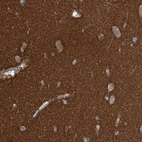 Immunohistochemical staining of human cerebral cortex shows strong positivity in neuropil.