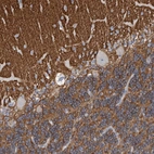 Immunohistochemical staining of human cerebellum shows moderate cytoplasmic positivity.