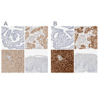 Immunohistochemical staining of human fallopian tube, kidney, liver and skin using Anti-RIDA antibody HPA023489 (A) shows similar protein distribution across tissues to independent antibody HPA022856 (B).