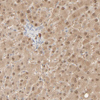 Immunohistochemical staining of human liver shows weak to moderate cytoplasmic and nuclear positivity in hepatocytes.