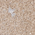 Immunohistochemical staining of human liver shows weak to moderate cytoplasmic and nuclear positivity in hepatocytes.