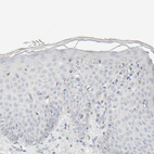 Immunohistochemical staining of human skin shows no positivity in squamous epithelial cells as expected.