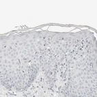 Immunohistochemical staining of human skin shows no positivity in squamous epithelial cells as expected.