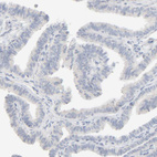 Immunohistochemical staining of human Fallopian tube shows no positivity in glandular cells as expected.