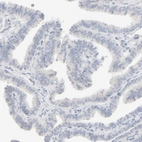 Immunohistochemical staining of human Fallopian tube shows no positivity in glandular cells as expected.