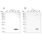 Western blot analysis using Anti-RIDA antibody HPA023489 (A) shows similar pattern to independent antibody HPA022856 (B).