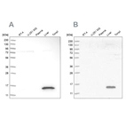 Western blot analysis using Anti-RIDA antibody HPA023489 (A) shows similar pattern to independent antibody HPA022856 (B).