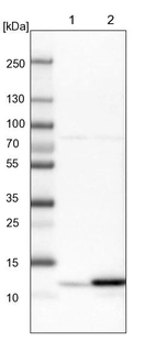 Lane 1: Mouse liver tissue lysate_br/_Lane 2: Rat liver tissue lysate