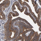 Immunohistochemical staining of human Fallopian tube shows strong cytoplasmic positivity in glandular cells.
