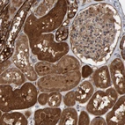 Immunohistochemical staining of human kidney shows strong cytoplasmic positivity in cells in tubules.