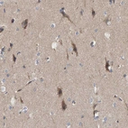 Immunohistochemical staining of human cerebral cortex shows weak to moderate cytoplasmic positivity in neurons.