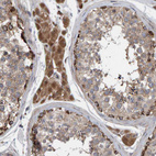 Immunohistochemical staining of human testis shows strong cytoplasmic positivity in Leydig cells.