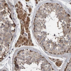 Immunohistochemical staining of human testis shows strong cytoplasmic positivity in Leydig cells.
