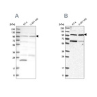 Anti-KIAA0753 Antibody
