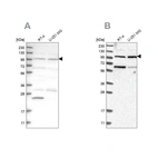 Western blot analysis using Anti-KIAA0753 antibody HPA023494 (A) shows similar pattern to independent antibody HPA023057 (B).