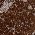 Immunohistochemical staining of human pancreas shows strong cytoplasmic positivity in exocrine glandular cells.
