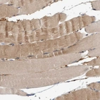 Immunohistochemical staining of human skeletal muscle shows moderate cytoplasmic positivity in myocytes.