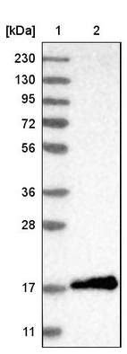Lane 1: Marker [kDa] 230, 130, 95, 72, 56, 36, 28, 17, 11_br/_Lane 2: Human cell line RT-4