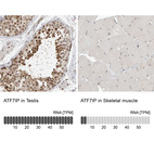 Anti-ATF7IP Antibody