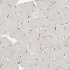 Immunohistochemical staining of human skeletal muscle shows low nuclear positivity in myocytes as expected.