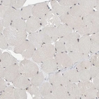 Immunohistochemical staining of human skeletal muscle shows low nuclear positivity in myocytes as expected.