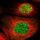 Immunofluorescent staining of human cell line A-431 shows localization to nucleoplasm & nuclear bodies.