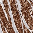 Anti-TTI2 Antibody