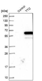 Anti-TTI2 Antibody
