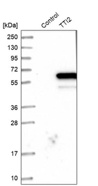 Western blot analysis in control (vector only transfected HEK293T lysate) and TTI2 over-expression lysate (Co-expressed with a C-terminal myc-DDK tag (~3.1 kDa) in mammalian HEK293T cells, LY410894).