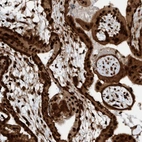 Anti-ZNF366 Antibody