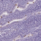 Immunohistochemical staining of human endometrium shows strong positivity in cilia.