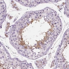Immunohistochemical staining of human testis shows moderate cytoplasmic positivity in spermatids and sperm.