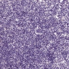 Immunohistochemical staining of human tonsil shows no positivity in lymphoid cells as expected.