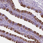 Anti-EFCAB1 Antibody