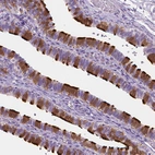 Immunohistochemical staining of human fallopian tube shows strong positivity in cilia.