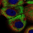 Immunofluorescent staining of human cell line A-431 shows localization to cytosol.
