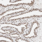 Immunohistochemical staining of human prostate shows moderate to strong positivity in nuclear speckles in glandular cells.
