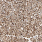 Anti-APBB2 Antibody