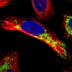 Immunofluorescent staining of human cell line U-251 MG shows positivity in mitochondria.