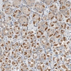 Immunohistochemical staining of human stomach shows moderate cytoplasmic positivity in glandular cells.