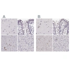 Anti-RUNDC3A Antibody