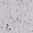 Immunohistochemical staining of human hippocampus using Anti-RUNDC3A antibody HPA023548.